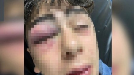 3013EA9C-1733-4E36-912D-55FF68199A71