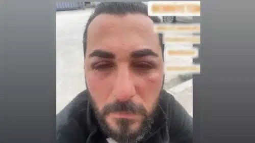 524F923B-5C3D-4DF2-AF44-81971A4954D3