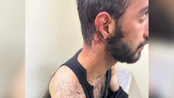 9336F699-CDAF-4D47-9328-EAE18A8EC101