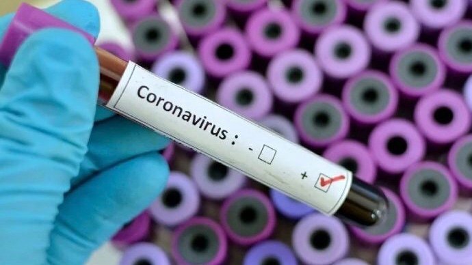 870B1595-5510-4DA6-8549-F14789BCF7E5