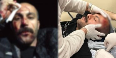 avukatsiddet-1140x570